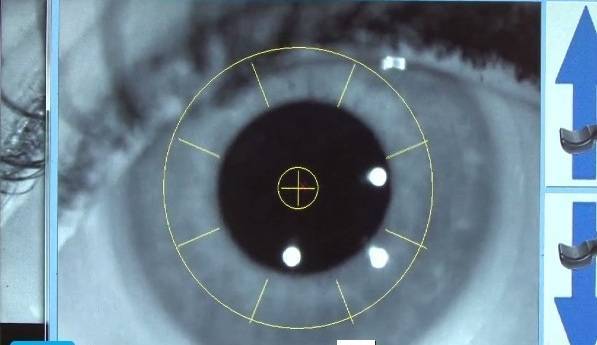 Jefferson City eye exam